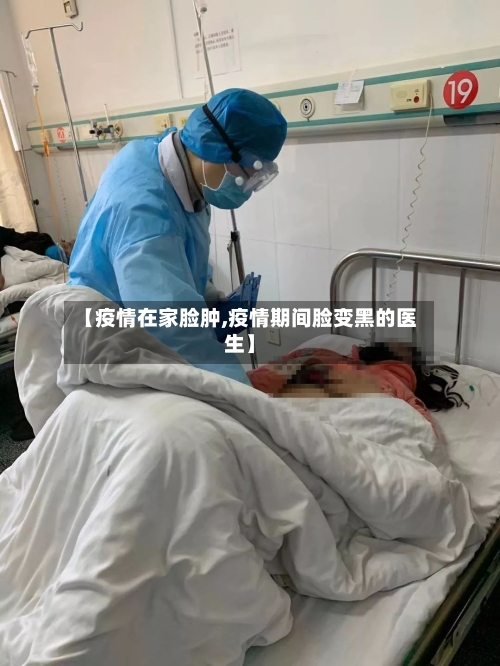【疫情在家脸肿,疫情期间脸变黑的医生】