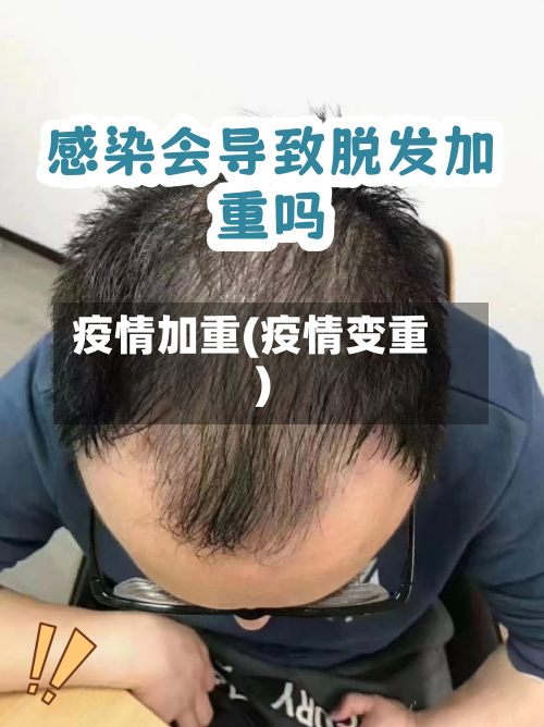 疫情加重(疫情变重)