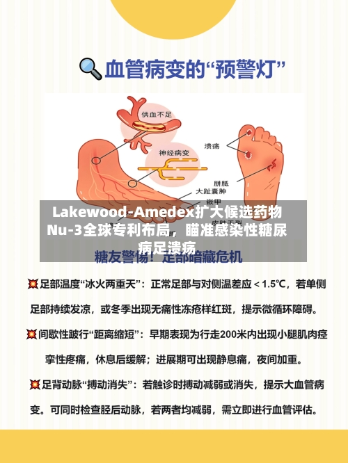 Lakewood-Amedex扩大候选药物Nu-3全球专利布局,瞄准感染性糖尿病足溃疡